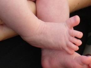 infant's toes fanning out and curling